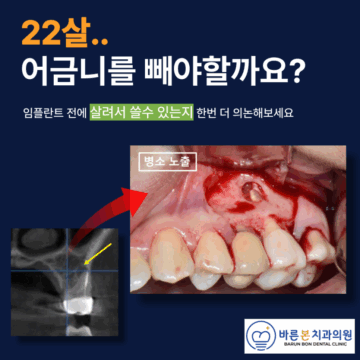 수원치과추천