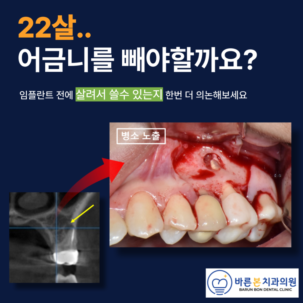 수원치과추천