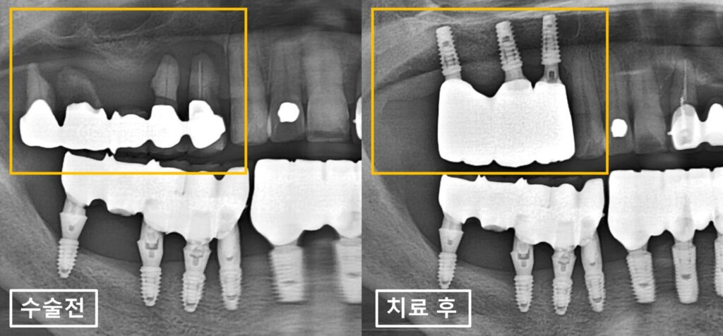 수원시청치과