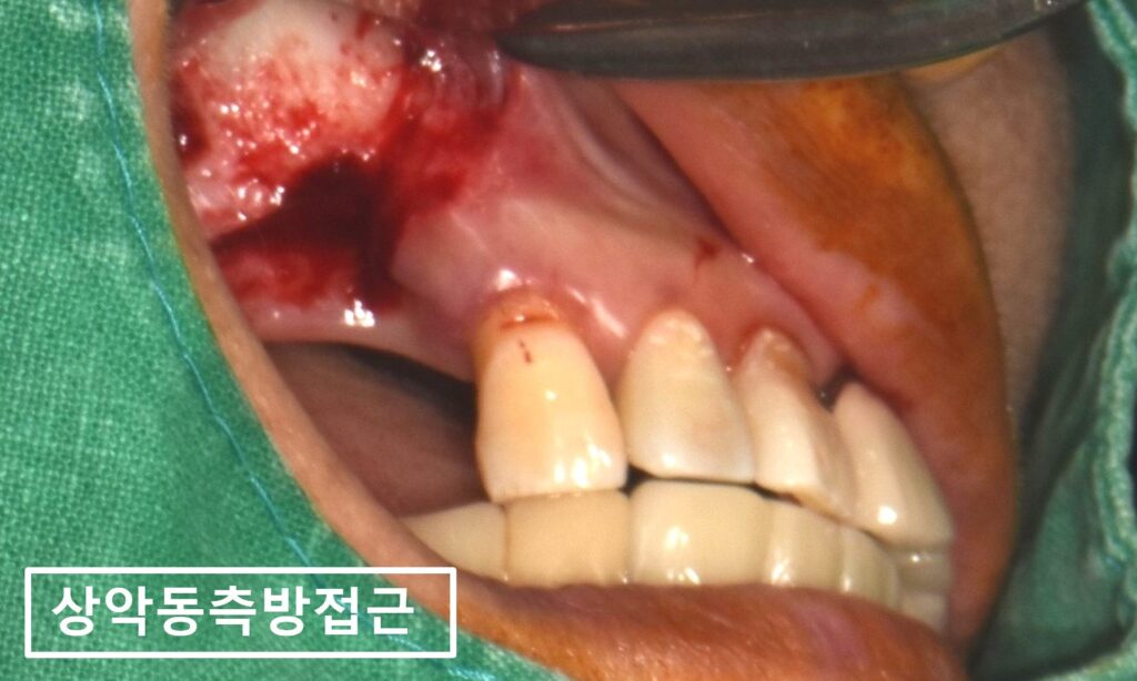수원시청치과
