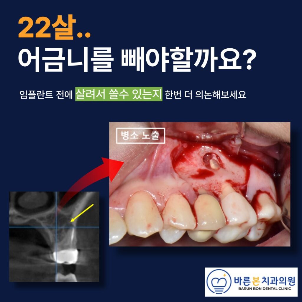 매탄동치과